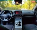 Зеленый Хендай Kona, объемом двигателя 0 л и пробегом 55 тыс. км за 16500 $, фото 36 на Automoto.ua