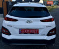 Белый Хендай Kona Electric, объемом двигателя 0 л и пробегом 95 тыс. км за 17500 $, фото 6 на Automoto.ua