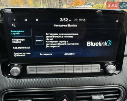 Белый Хендай Kona Electric, объемом двигателя 0 л и пробегом 58 тыс. км за 17499 $, фото 96 на Automoto.ua