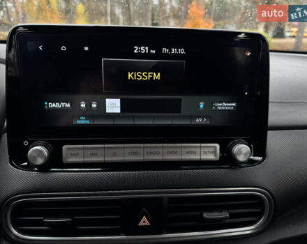 Белый Хендай Kona Electric, объемом двигателя 0 л и пробегом 58 тыс. км за 17499 $, фото 83 на Automoto.ua