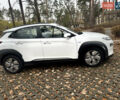 Белый Хендай Kona Electric, объемом двигателя 0 л и пробегом 59 тыс. км за 16900 $, фото 2 на Automoto.ua
