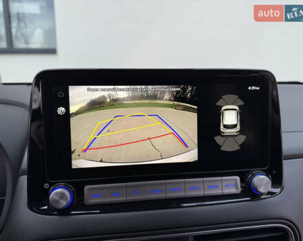 Белый Хендай Kona Electric, объемом двигателя 0 л и пробегом 96 тыс. км за 19500 $, фото 66 на Automoto.ua