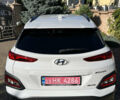Белый Хендай Kona Electric, объемом двигателя 0 л и пробегом 88 тыс. км за 17900 $, фото 9 на Automoto.ua