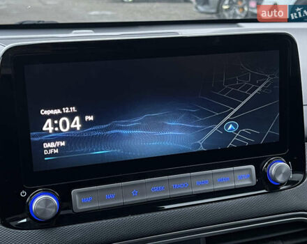 Білий Хендай Kona Electric, об'ємом двигуна 0 л та пробігом 70 тис. км за 19828 $, фото 75 на Automoto.ua