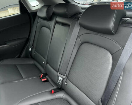 Белый Хендай Kona Electric, объемом двигателя 0 л и пробегом 111 тыс. км за 18570 $, фото 36 на Automoto.ua