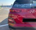Хендай Kona Electric, объемом двигателя 0 л и пробегом 129 тыс. км за 15999 $, фото 16 на Automoto.ua