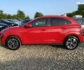 Хендай Kona Electric, об'ємом двигуна 0 л та пробігом 96 тис. км за 19900 $, фото 15 на Automoto.ua