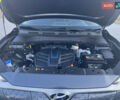 Серый Хендай Kona Electric, объемом двигателя 0 л и пробегом 31 тыс. км за 15450 $, фото 39 на Automoto.ua