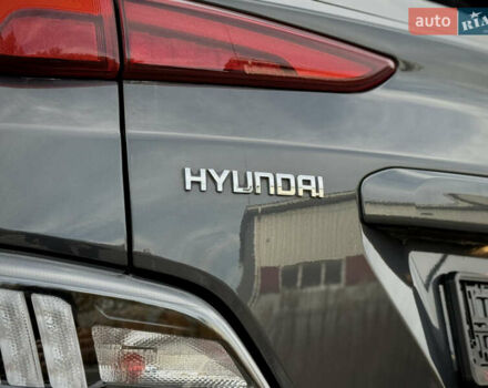 Серый Хендай Kona Electric, объемом двигателя 0 л и пробегом 87 тыс. км за 19552 $, фото 45 на Automoto.ua