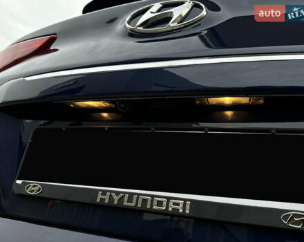 Синий Хендай Kona Electric, объемом двигателя 0 л и пробегом 65 тыс. км за 18500 $, фото 65 на Automoto.ua