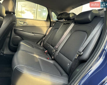 Синий Хендай Kona Electric, объемом двигателя 0 л и пробегом 65 тыс. км за 18500 $, фото 87 на Automoto.ua