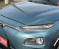 Зеленый Хендай Kona Electric, объемом двигателя 0 л и пробегом 154 тыс. км за 16500 $, фото 8 на Automoto.ua