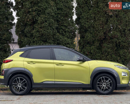 Зеленый Хендай Kona Electric, объемом двигателя 0 л и пробегом 103 тыс. км за 17300 $, фото 5 на Automoto.ua