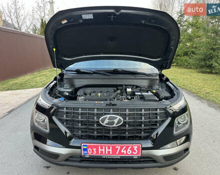 Черный Хендай Venue, объемом двигателя 1.59 л и пробегом 133 тыс. км за 14600 $, фото 51 на Automoto.ua