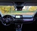 Белый Киа Другая, объемом двигателя 1.6 л и пробегом 50 тыс. км за 13700 $, фото 9 на Automoto.ua