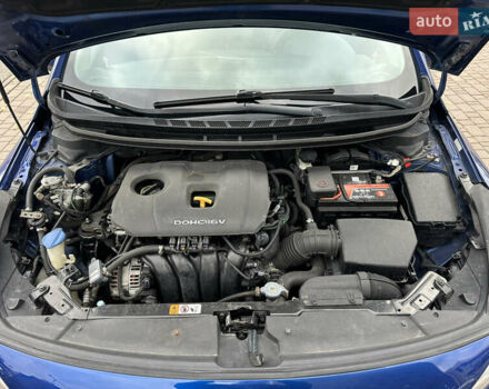Кіа Форте 2017 у Києві на Automoto.ua Синій Кіа Форте, об'ємом двигуна 2 л та пробігом 145 тис. км за 9900 $, фото 17 на Automoto.ua