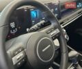 Серый Мерседес Е-Класс, объемом двигателя 3.2 л и пробегом 413 тыс. км за 9200 $, фото 17 на Automoto.ua