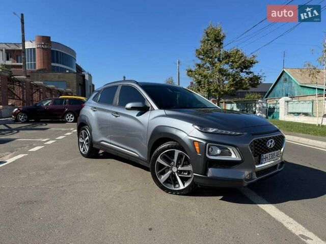 Сірий Хендай Kona, об'ємом двигуна 1.59 л та пробігом 88 тис. км за 19800 $, фото 1 на Automoto.ua