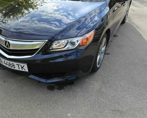 Синий Акура ИЛХ, объемом двигателя 2 л и пробегом 105 тыс. км за 11200 $, фото 29 на Automoto.ua