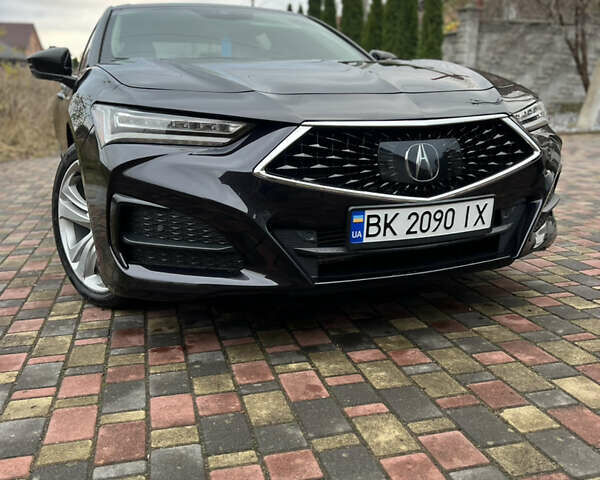 Черный Акура ТЛХ, объемом двигателя 2 л и пробегом 68 тыс. км за 25500 $, фото 3 на Automoto.ua