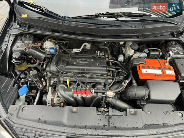 Хендай Акцент 2011 в Полтаве на Automoto.ua Черный Хендай Акцент, объемом двигателя 1.4 л и пробегом 186 тыс. км за 5999 $, фото 27 на Automoto.ua