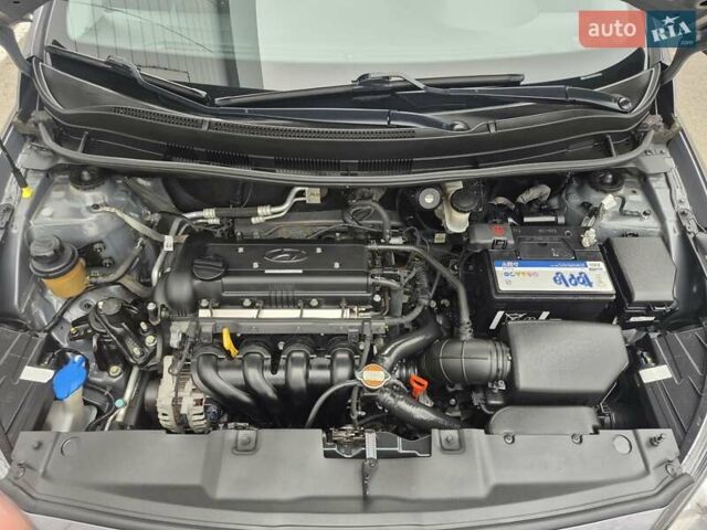 Серый Хендай Акцент, объемом двигателя 1.6 л и пробегом 90 тыс. км за 9650 $, фото 61 на Automoto.ua