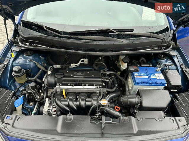 Синий Хендай Акцент, объемом двигателя 1.4 л и пробегом 146 тыс. км за 8700 $, фото 13 на Automoto.ua