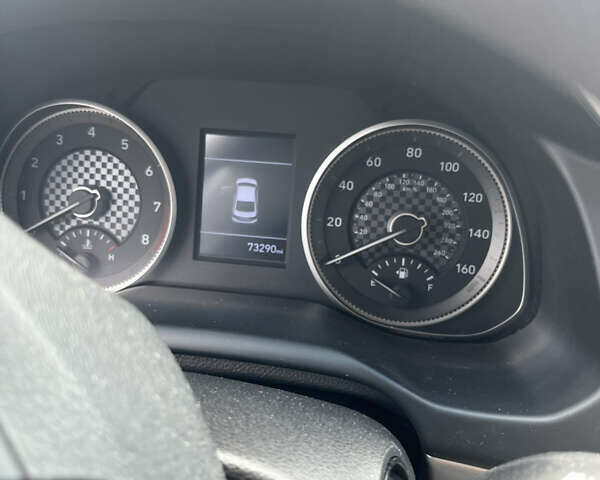 Белый Хендай Элантра, объемом двигателя 2 л и пробегом 118 тыс. км за 13200 $, фото 14 на Automoto.ua