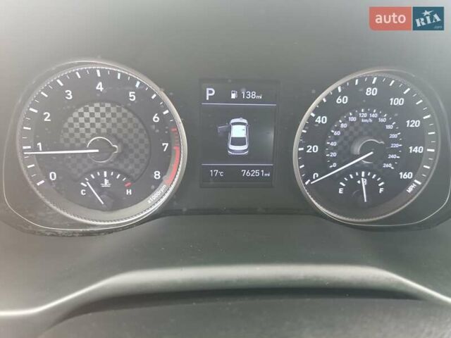 Хендай Элантра 2020 в Киеве на Automoto.ua Серый Хендай Элантра, объемом двигателя 2 л и пробегом 123 тыс. км за 12900 $, фото 4 на Automoto.ua