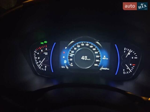 Белый Хендай Санта Фе, объемом двигателя 2.2 л и пробегом 80 тыс. км за 34700 $, фото 7 на Automoto.ua