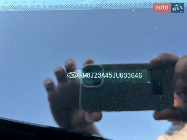 Хендай Туксон 2018 в Киеве на Automoto.ua Черный Хендай Туксон, объемом двигателя 2 л и пробегом 106 тыс. км за 15500 $, фото 27 на Automoto.ua