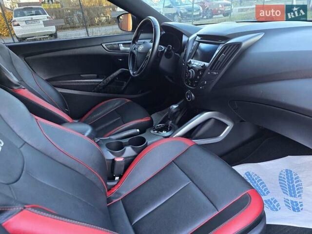 Черный Хендай Велостер, объемом двигателя 1.6 л и пробегом 180 тыс. км за 9950 $, фото 13 на Automoto.ua