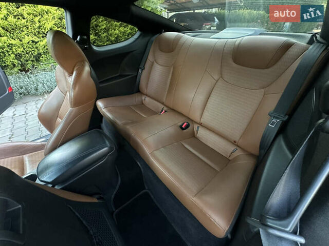 Черный Хендай Genesis Coupe, объемом двигателя 2 л и пробегом 119 тыс. км за 11200 $, фото 35 на Automoto.ua