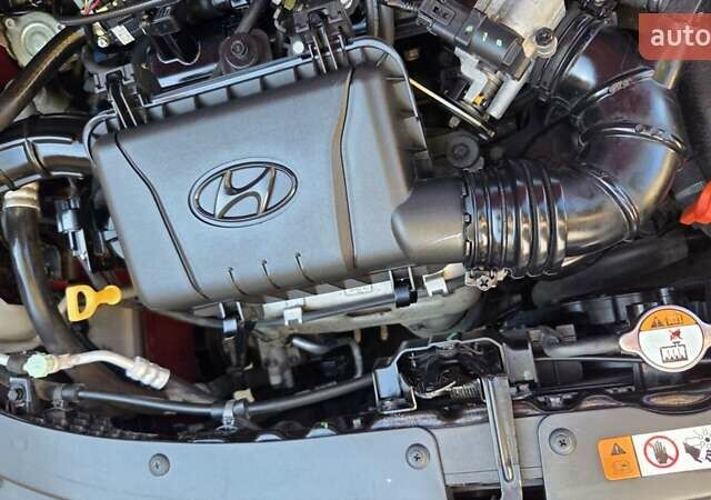 Красный Хендай и10, объемом двигателя 1.2 л и пробегом 48 тыс. км за 9000 $, фото 43 на Automoto.ua