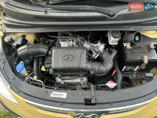 Желтый Хендай и10, объемом двигателя 1.1 л и пробегом 117 тыс. км за 5400 $, фото 2 на Automoto.ua