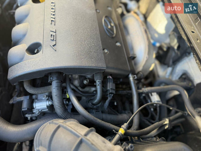 Хендай i30 2009 в Борисполе на Automoto.ua Черный Хендай i30, объемом двигателя 1.6 л и пробегом 229 тыс. км за 7000 $, фото 57 на Automoto.ua