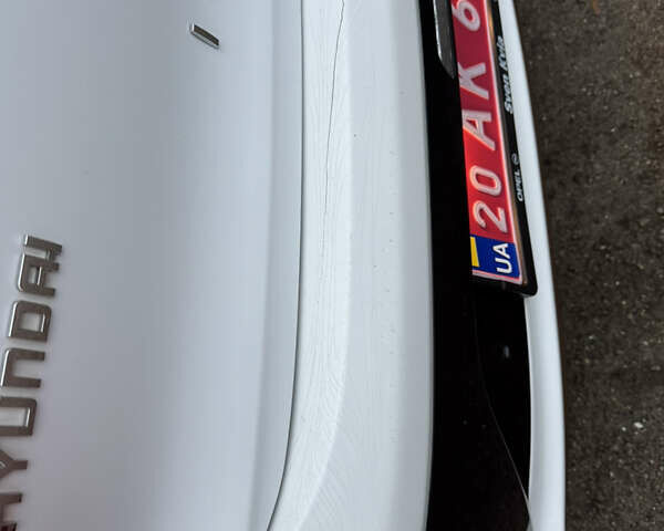 Белый Хендай Ioniq, объемом двигателя 0 л и пробегом 156 тыс. км за 11600 $, фото 24 на Automoto.ua