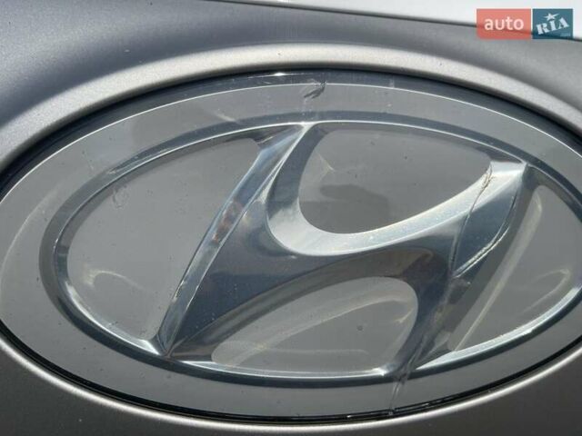 Белый Хендай Ioniq, объемом двигателя 0 л и пробегом 124 тыс. км за 15000 $, фото 2 на Automoto.ua