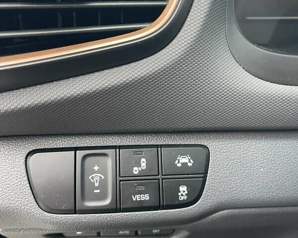 Черный Хендай Ioniq, объемом двигателя 0 л и пробегом 113 тыс. км за 13300 $, фото 28 на Automoto.ua