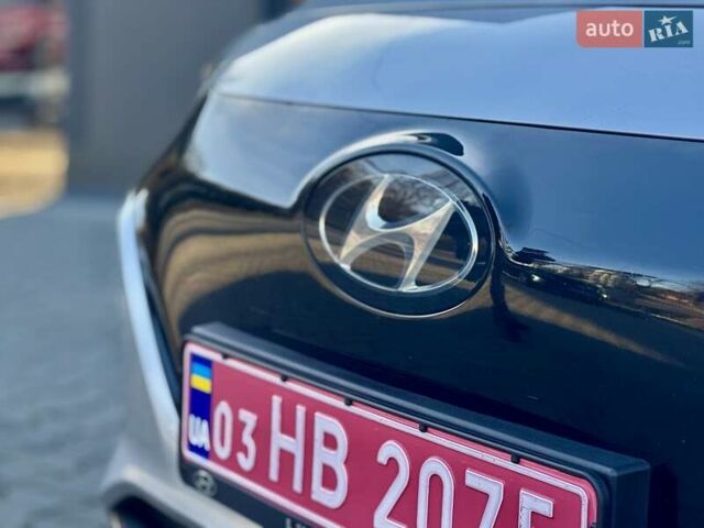 Серый Хендай Ioniq, объемом двигателя 0 л и пробегом 87 тыс. км за 11555 $, фото 38 на Automoto.ua
