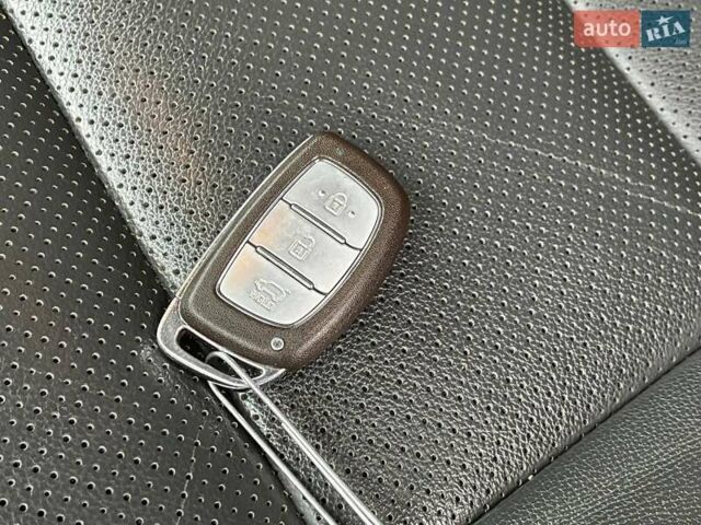 Сірий Хендай Ioniq, об'ємом двигуна 0 л та пробігом 131 тис. км за 16500 $, фото 42 на Automoto.ua