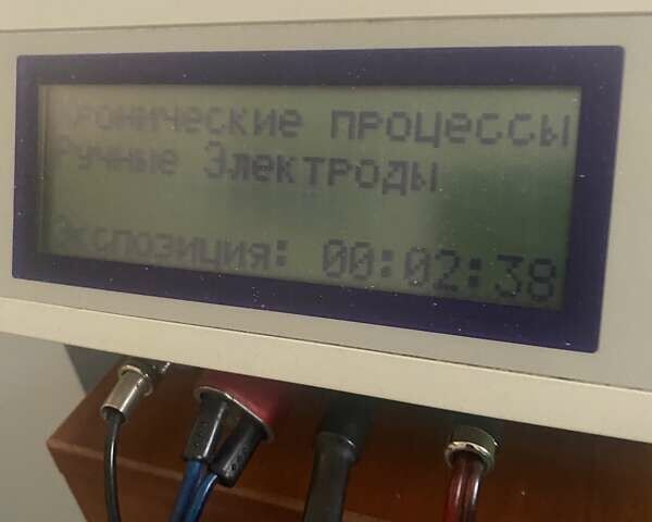 Білий Хендай Kona, об'ємом двигуна 0 л та пробігом 113 тис. км за 18300 $, фото 60 на Automoto.ua