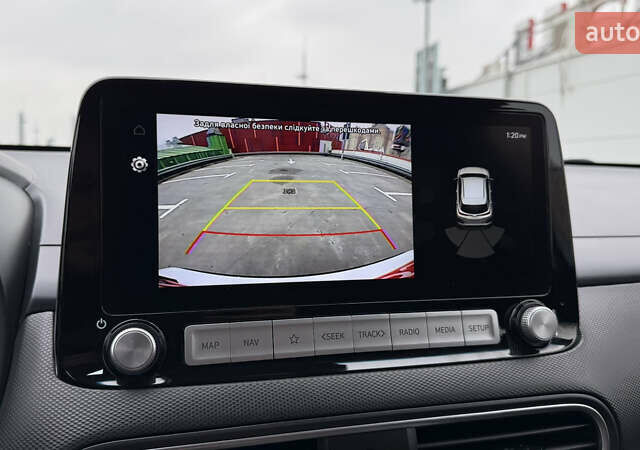 Белый Хендай Kona, объемом двигателя 0 л и пробегом 70 тыс. км за 16950 $, фото 33 на Automoto.ua