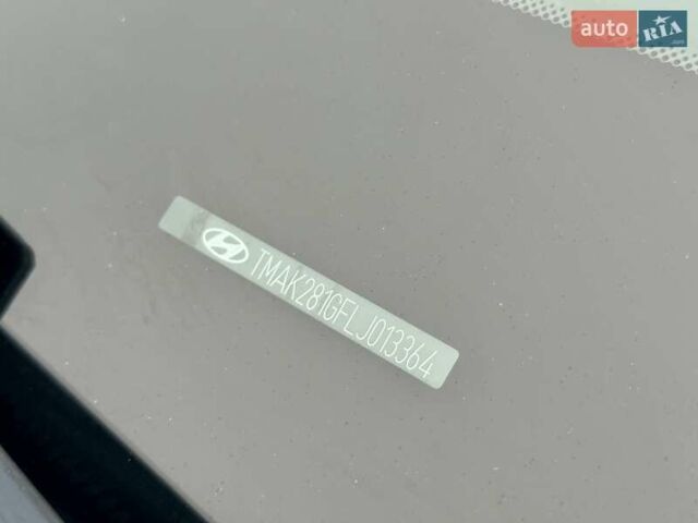 Белый Хендай Kona, объемом двигателя 0 л и пробегом 115 тыс. км за 17250 $, фото 28 на Automoto.ua