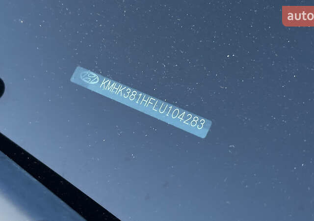 Білий Хендай Kona, об'ємом двигуна 0 л та пробігом 53 тис. км за 15900 $, фото 1 на Automoto.ua