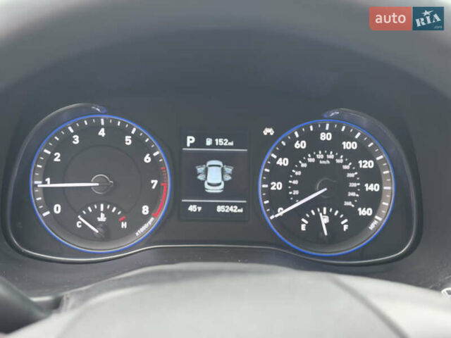 Чорний Хендай Kona, об'ємом двигуна 2 л та пробігом 137 тис. км за 14800 $, фото 20 на Automoto.ua