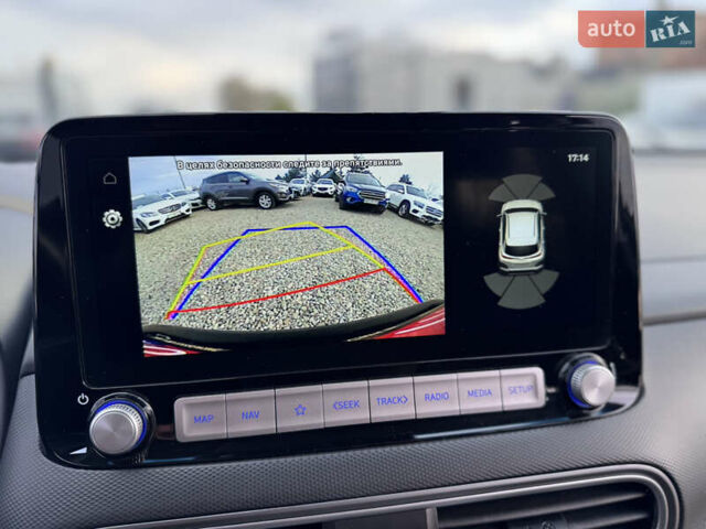 Черный Хендай Kona, объемом двигателя 0 л и пробегом 140 тыс. км за 17900 $, фото 43 на Automoto.ua