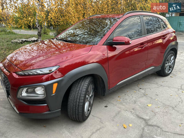 Червоний Хендай Kona, об'ємом двигуна 1.59 л та пробігом 43 тис. км за 18500 $, фото 3 на Automoto.ua
