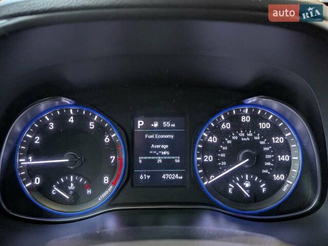 Сірий Хендай Kona, об'ємом двигуна 1.59 л та пробігом 75 тис. км за 15500 $, фото 20 на Automoto.ua