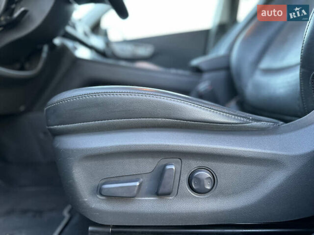 Серый Хендай Kona, объемом двигателя 0 л и пробегом 126 тыс. км за 17300 $, фото 51 на Automoto.ua